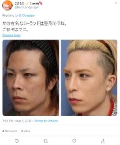 ローランドの整形写真