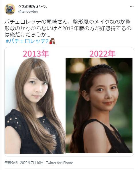 尾崎美紀の整形疑惑
